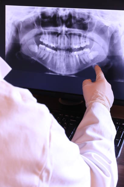 Best Dental Abscess Treatment in Hewlett, NY